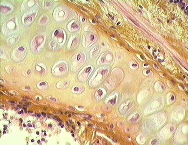 Hematoxylin, eosin a šafrán