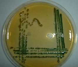 Oenococcus