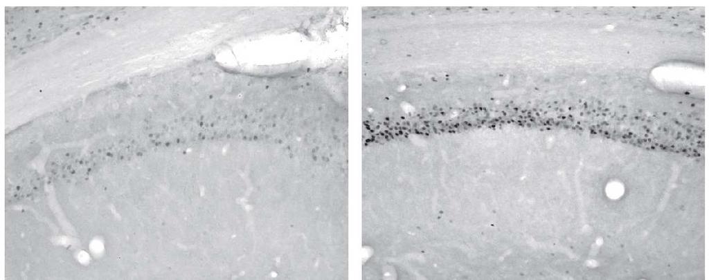 6. Metody detekce exprese IEGs Experimentální zvířata vystavená specifické stimulaci, případně vykonávající určitou behaviorální úlohu, jsou po experimentu usmrcena, jejich mozky nařezány a