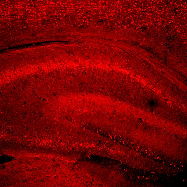 A B Obr. 13 Fluorescenční značení exprese Egr-1(červeně) v hipokampu mláděte myši (A) a zvýšené exprese Arc (červeně) v hipokampu po aktivitě myši (B). (http://www.flickr.