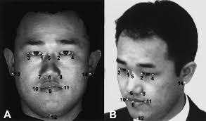 5. Komparace portrétních fotografií Metoda komparace portrétních fotografií spočívá ve vzájemném porovnání somatických znaků obličejů zachycených na fotografiích.