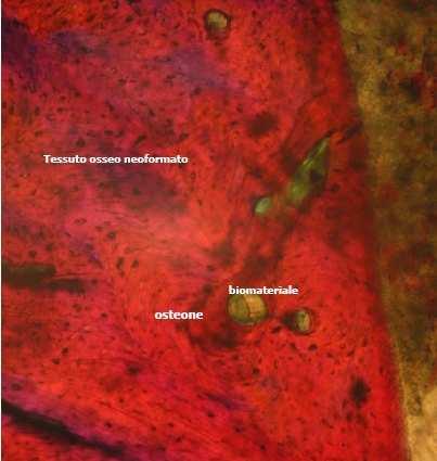 Histologie Proces novotvorby kostí Osteoblastey vedou ke kostním buňkám Osteony obsahují kostní buňky Kostní buňky
