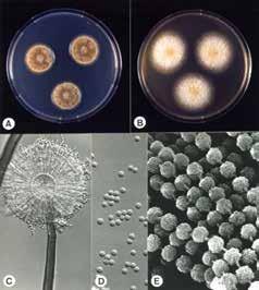 jpg Aspergillus flavus napadá např.