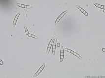 jpg/220px-trichoderma_harzianum.jpg DEUTEROMYCOTA Trichoderma sp.