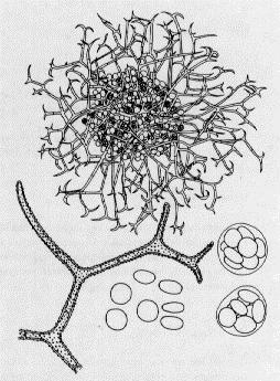 ASCOMYCOTA Chaetomium sp. http://www.doctorfungus.org/thefungi/img/cha1_l.