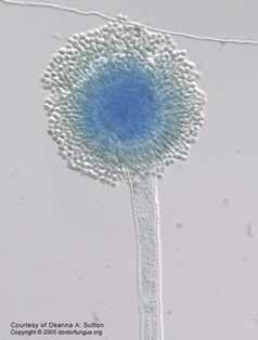 ASPERGILÓZA Přibližně 20 druhů rodu Aspergillus je v nějaké míře schopno infikovat člověka velká většina je způsobena druhy A. fumigatus, A. niger, A. nidulans, A. terreus, A. flavus.