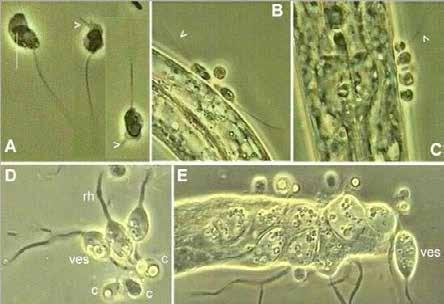 Catenaria anguillulae http://helios.