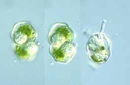 Oddělení: OOMYCOTA Stélka: u primitivních typů: Jednobuněčná endobiotická (uvnitř protoplastu hostitele, bez buněčné stěny), monocentrická (ze stélky vzniká 1 sporangium) eukarpická (část se přemění