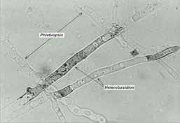 HYFÁLNÍ INTERFERENCE Někteří zástupci skupiny Basidiomycota antagonizují při kontaktu jiné houby, např. jiné Basidiomycota K hyfální interferenci dochází několik minut po kontaktu hyf.