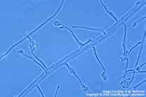 CEPHALOSPORINY Nový druh antibiotik byl izolován z plísně rodu Cephalosporium (nyní zařazováno do rodu Acremonium). Cephalosporiny působí i proti některým Gram-negativním bakteriím. http://www.