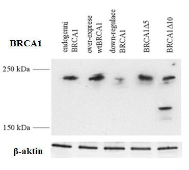 velikost izoformy BRCA1 5 je 210kDa).