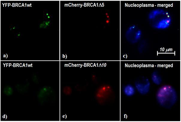 i v případě BRCA1 10 (Obr. XVIe), kdy chybí nadpoloviční část proteinu.