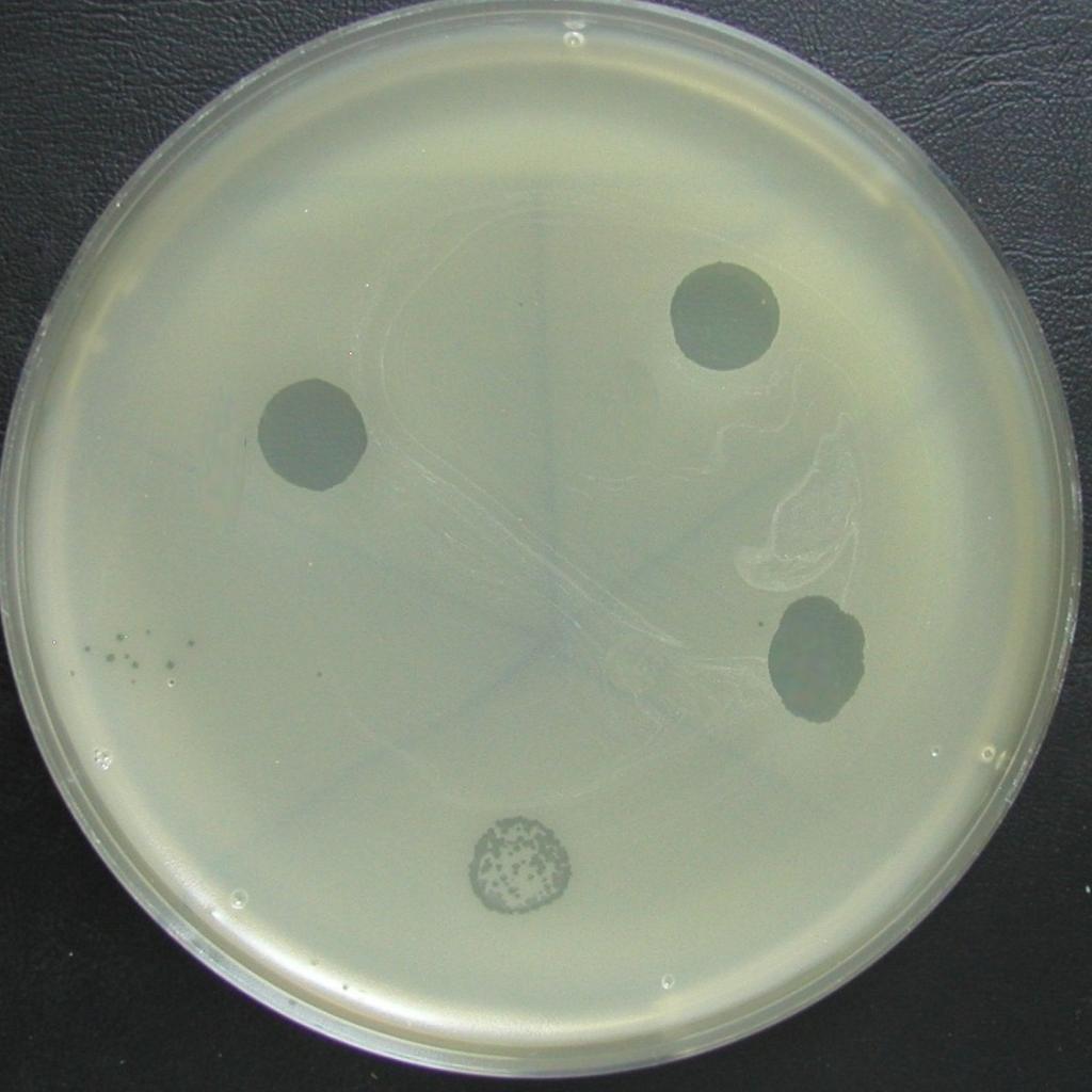Bakteriofágová terapie v praxi Na tomto obrázku vidíte kmen stafylokoka, naočkovaného tak, že pokrývá celý povrch média.