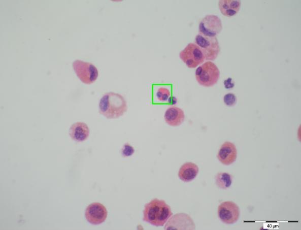 Obr.13 Eozinofilní