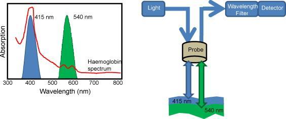 Narrow-band imaging - NBI Zlepšení kontrastu mezi abnormální lézí a normální sliznici měchýře pomocí restrikce světelného optického spektra použitého v průběhu CSK.
