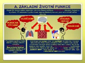 Představení jednotlivých ZŽF při 2. 4. kliknutí myši, projevy poruchy jednotlivých ZŽF 5. kliknutí myši. Předchozí snímek uvádí jako prioritu zjištění stavu ZŽF.