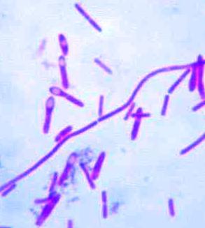 bakterie gramnegativní tyčky