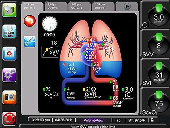 Preventivní postupy monitorace hemodynamiky