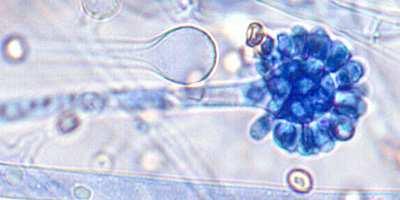 Cunninghamella bertholletiae rhizoidy vyvinuté, stolony chybí sporangiofory vzpřímené, větvené, zakončené sporogenními hlavicemi (vezikuly) sporogenní hlavice pokryté krátkými stopkami nesoucími