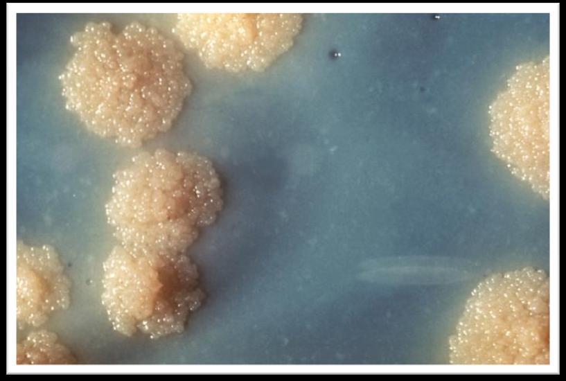 Obr. 4 Löwensteinova-Jensenova půda s typickými koloniemi Mycobacterium tuberculosis Detailní záběr na kolonie Mycobacterium tuberculosis narostlé na Löwensteinově-Jensenově půdě: nažloutlý, hrub ý