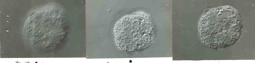 Pozdní fáze pylové embryogeneze: