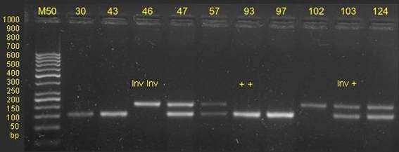 Obr. 2 Stanovení genotypů intron 13 genu KIT (RFLP).