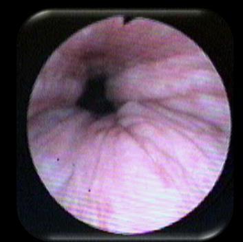 (NOHL) classification: a new system of