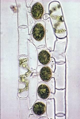 Odd.: Charophyta MESOSTIGMATOPHYCEAE Třída: ZYGNEMATOPHYCEAE Jednobuněčné, vláknité Charakteristické uspořádání chloroplastu (stočen do spirály (Spirogyra) nebo je hvězdicovitě laločnatý (Zygnema)
