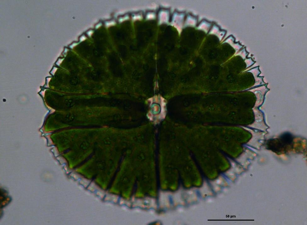 Odd.: Charophyta Třída: Zygnematophyceae