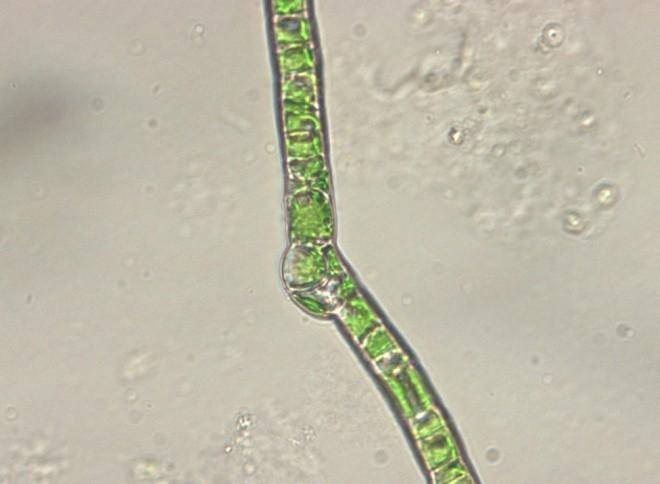 3. Prázdná zoosporangia (buňky) se