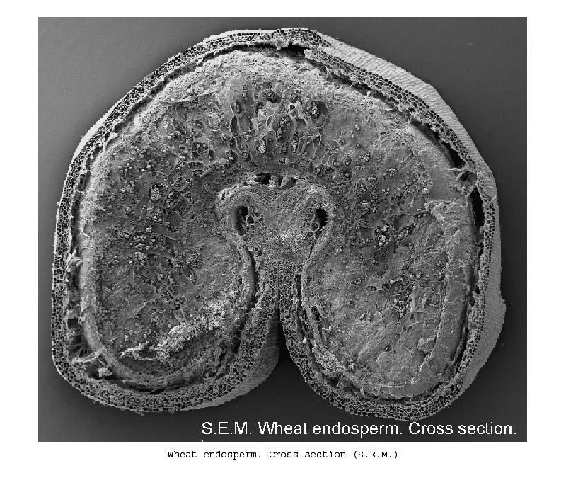 UTB ve Zlíně, Fakulta technologická 26 2.1 Složení endospermu Pšeničný endosperm obklopuje embryo (klíček) a obsahuje kromě škrobu, který slouží především jako výživa, také bílkoviny a oleje.