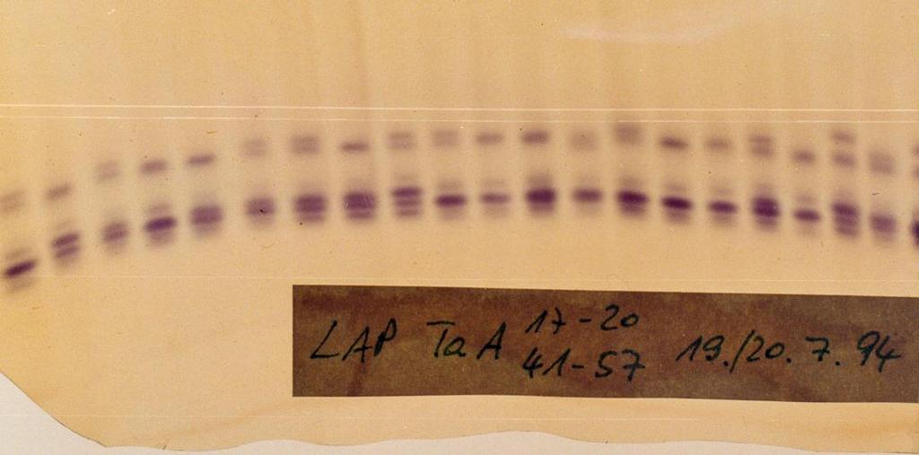 4. hodnocení zymogramu - zymogram