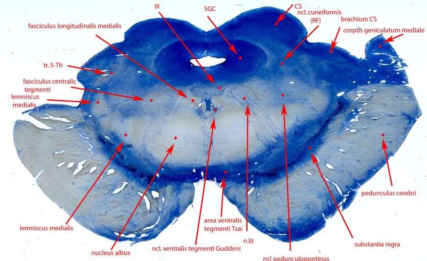 MESENCEPHALON ŘEZ