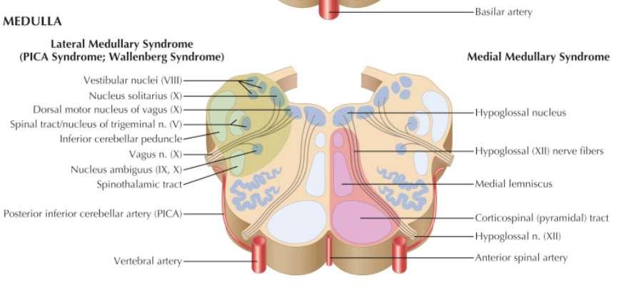 Syndrom laterální medully oblongaty Větve a. vertebralis největší větví je a.