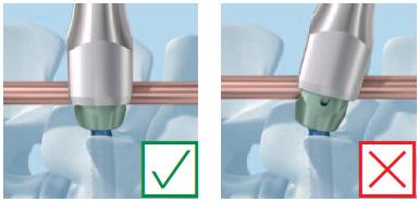 Šroubové implantáty MATRIX dosahují standardního výkonu pouze při utažení požadovaným utahovacím momentem 10 Nm.