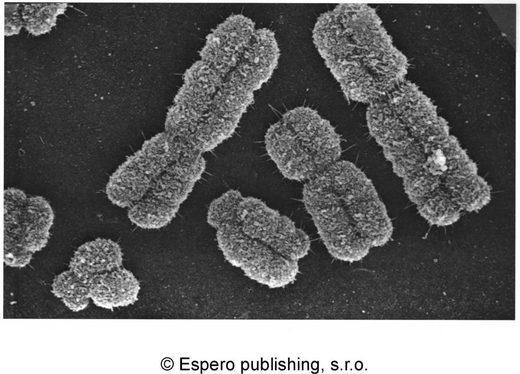 Mitotické chromosomy na