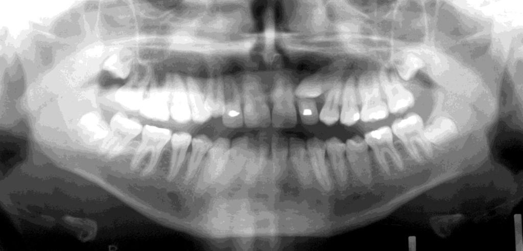 29 Ortopantomogram  