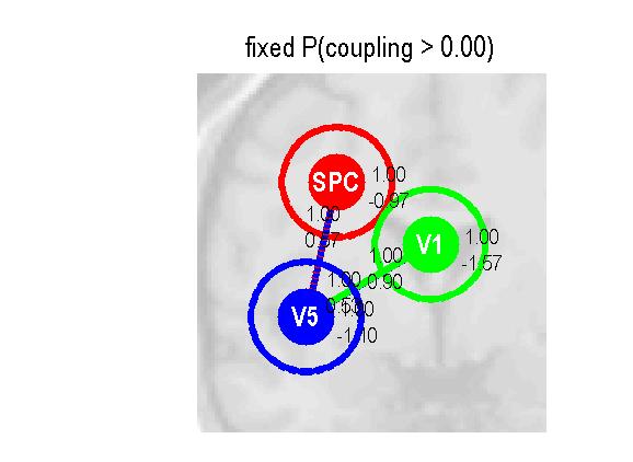 Dialogové okno toolboxu SPM8 Po spuštění je uživateli nabídnuto několik akcí. Pokud DCM analýzu uživatel začíná, definuje si nejprve parametry modelu, dat a experimentálních podmínek.