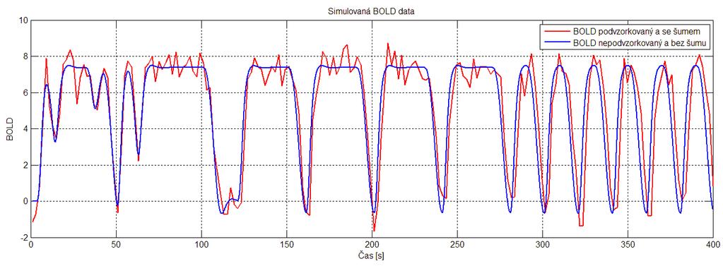 Pro porovnání je na grafu výše podvzorkovaný BOLD signál s repetičním časem TR = 2 s. Tento BOLD signál s přičteným šumem s poměrem SNR = 5 je na grafu níže.