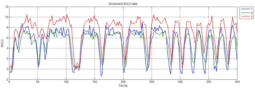 Parametry, znázorněné na předchozím obrázku byly použity pro generování BOLD signálů, které jsou zachyceny na následujícím grafu. Za oblast vstupu signálu v původním modelu je považována oblast 1.