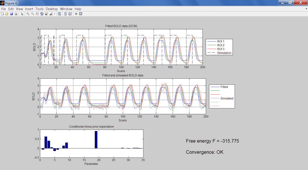 mezi apriorními a aposteriorními parametry odhadu metodou DCM. Vpravo dole je zobrazena informace o volné energii (free energy).