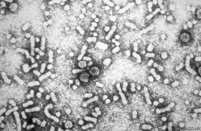 Hepatitis B virus (3) neinfekční