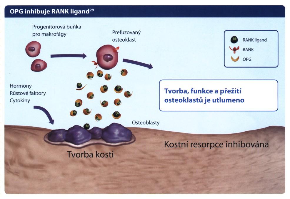 Signální dráha RANK ligandu - RANKL RANKL je základním mediátorem tvorby, funkce a přežívání OK OK jsou stimulovány RANKL U postmenopauzální OP je produkce RANKL