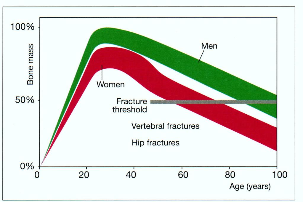 Peak bone mass