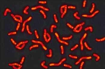 Chromozomy Geny jsou u eukaryotických organizmů z převážnéčásti umístěny právě na chromozómech v b. jádře. Jejich velikost a tvar jsou rozmanité, ale druhově shodné a stálé.