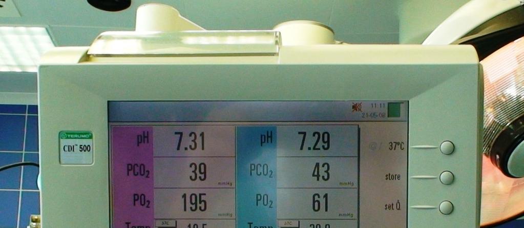 Obr. 7 Vlevo monitor, vpravo pak systém kalibračních plynů systému CDI 500 4.1.