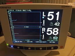 standardizace algoritmů výpočtu rsco2 V klinické praxi 30 let pořád není dostatečné