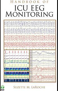 EEG U pacientů s TBI frekventní EPI aktivita Majorita