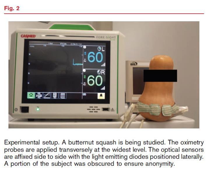 Závěr U pacienta s kraniotraumatem je nutný neuromonitoring V případě, že je to možné (bezpečné), vzbudit pacienta po kontrolním CT vyšetření (po 4 hodinách) neuromonitoring = klinické vyšetření,