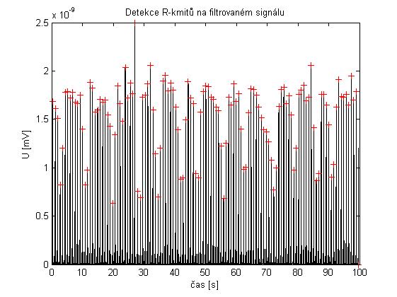 Správně detekovaných QRS komplexů bylo 17198 z celkového počtu 17676, tedy po dosazení do vzorců dostaneme výsledné hodnoty: S = 17198 100 = 97,30 % 17198 + 478 PPH = 17198 100 = 98,08 % 17198 + 337